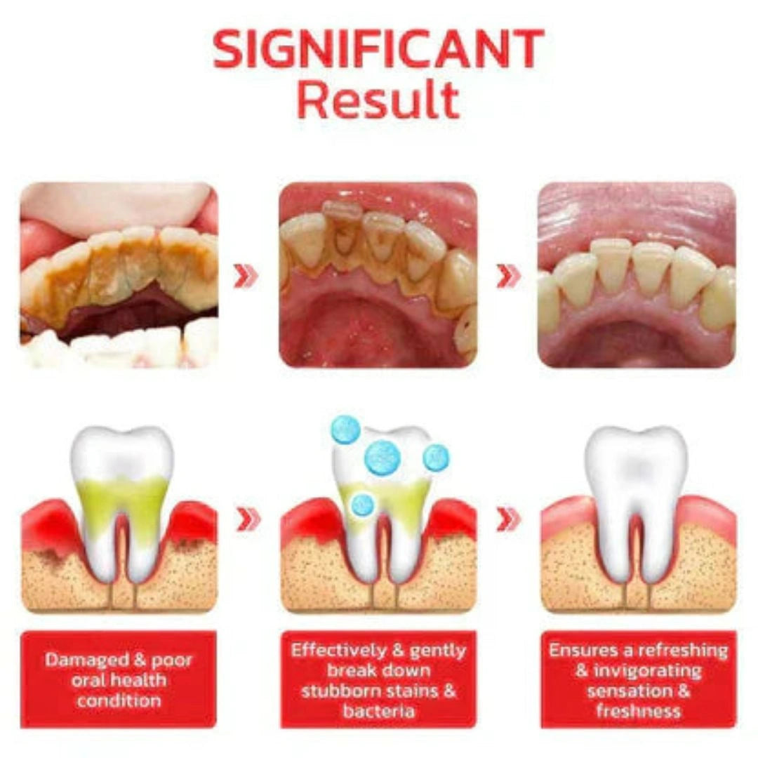 Sp-4 probiotic whitening toothpaste, Teeth Whitener Toothpaste, Natural Tooth Whitener (Buy 1 Get 1 Free)