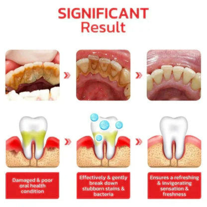 Sp-4 probiotic whitening toothpaste, Teeth Whitener Toothpaste, Natural Tooth Whitener (Buy 1 Get 1 Free)